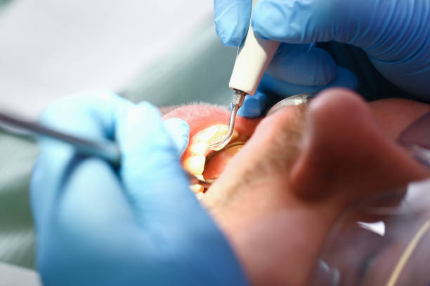 Best Emergency Dental Services for Seniors in Bel Air North, MD
