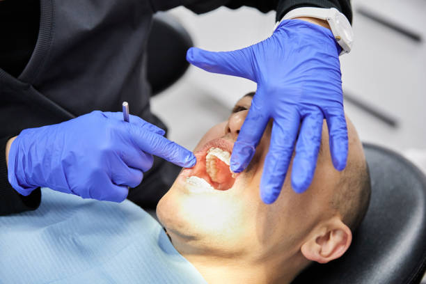 Best Emergency Dental Care for Abscessed Tooth in Bel Air North, MD